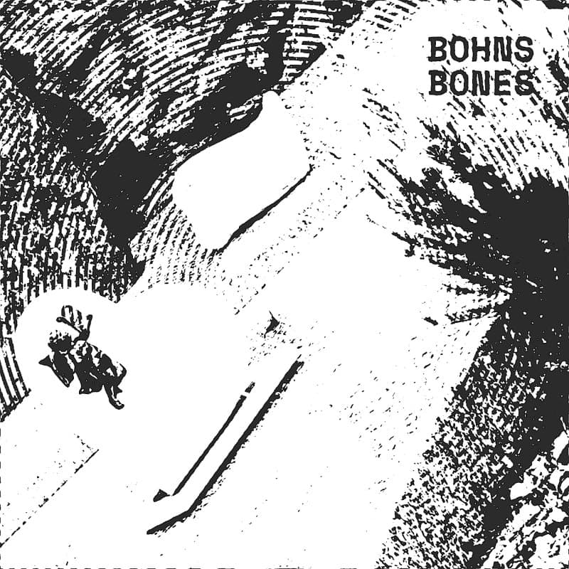 Bones